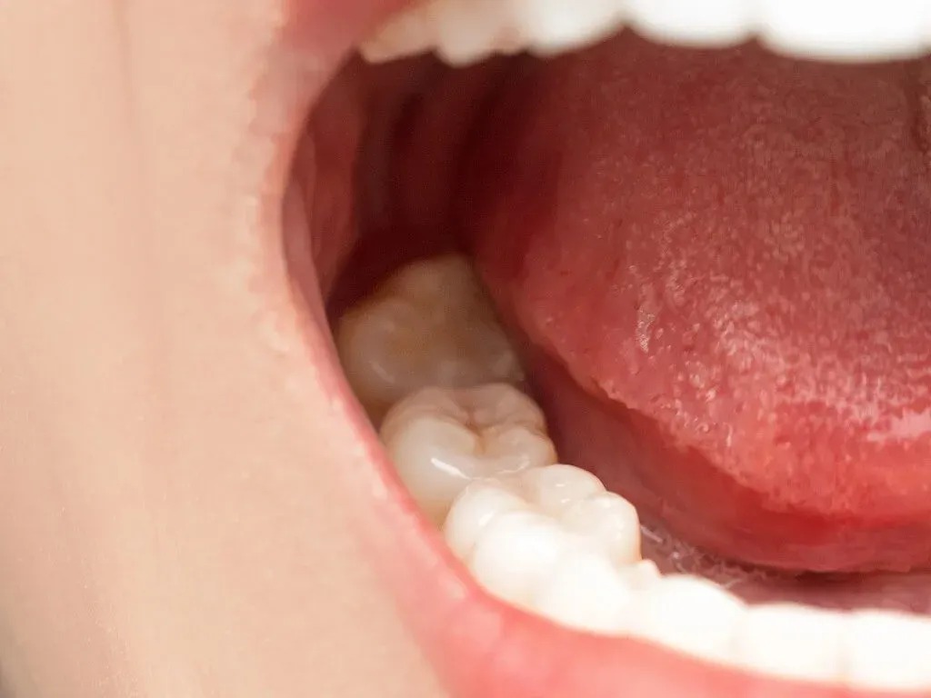 Boca aberta em close, mostrando a superfície da língua, a mucosa interna da bochecha e os dentes posteriores