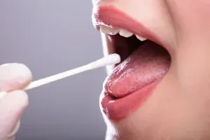 Coleta de uma amostra da mucosa da boca com haste, durante o exame